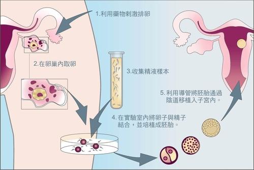 济南试管婴儿移植的成功率是多少？如何避免所有弊端