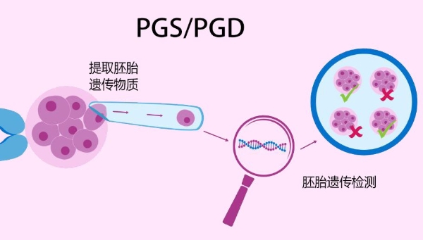 台州助孕龙凤胎群-随着三胎政策的出台，美国的试管婴儿技术可以帮助你实现良好的妊娠。